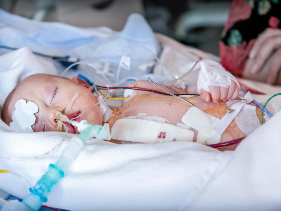 Nova smrt na otroški srčni kirurgiji