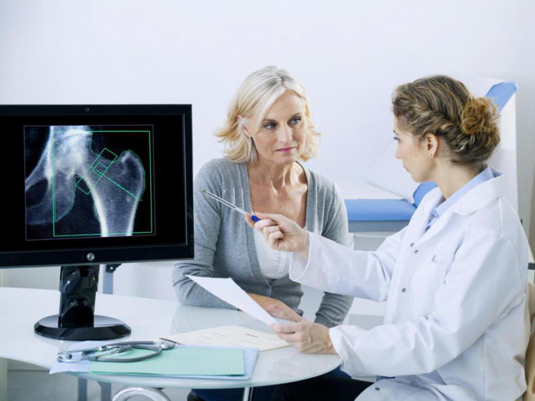 Osteoporoza je nepotrebna, izčrpavajoča in draga bolezen